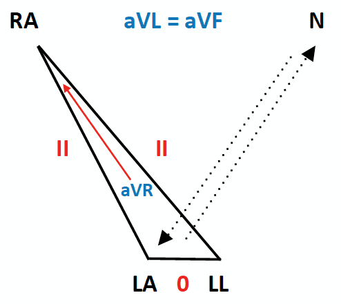 ECG Lead reversal LA:RL(N) reversal