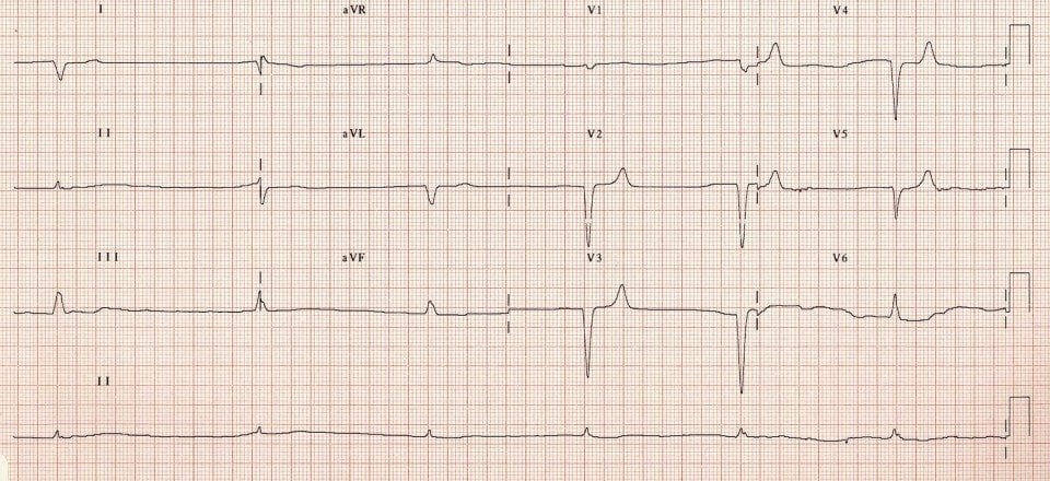 TOP 100 ECQ QUIZ LITFL 003
