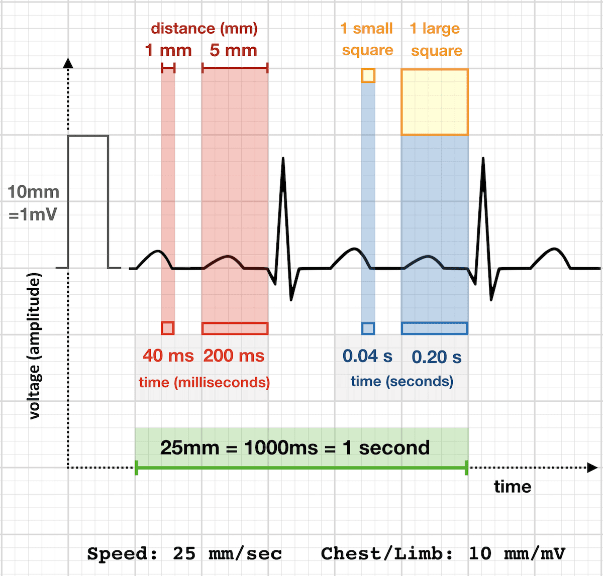ECG RATE 25 mm sec standard paper speed