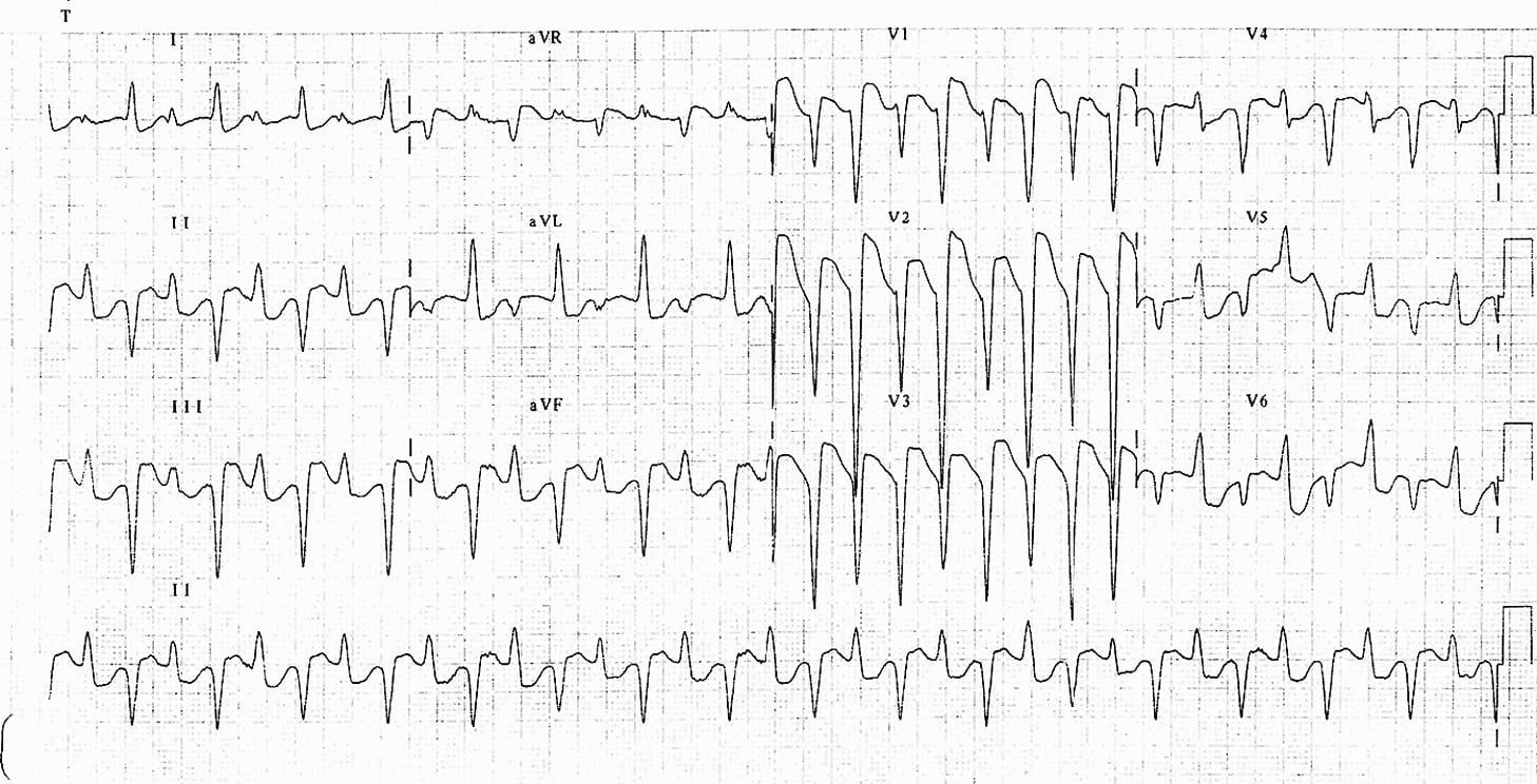 ECG Exigency 010