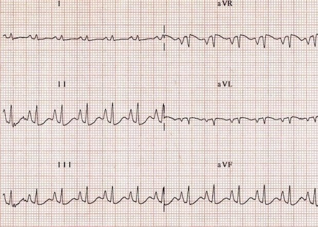 Vertical AXIS example 005