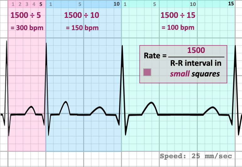 ECG Rate calculation Small square method