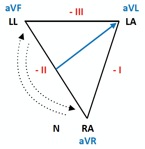 ECG Lead reversal RA-LL diagram