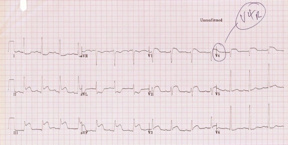 TOP 100 ECQ QUIZ LITFL 001b