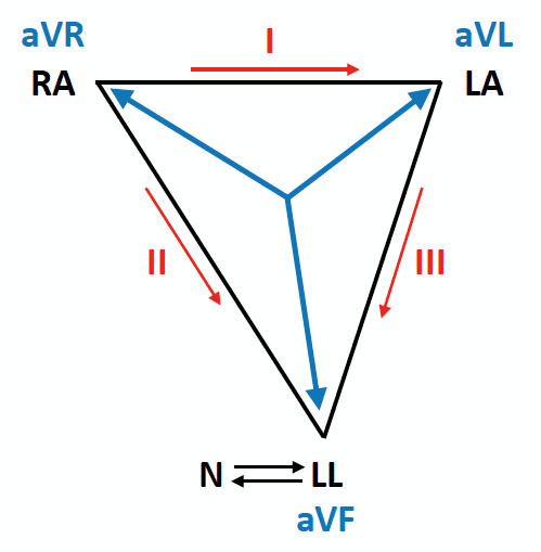 ECG Lead reversal RL-LL