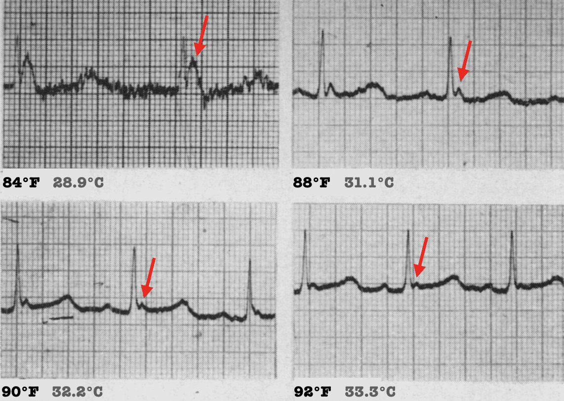 Rewarming camel hump J deflection 2