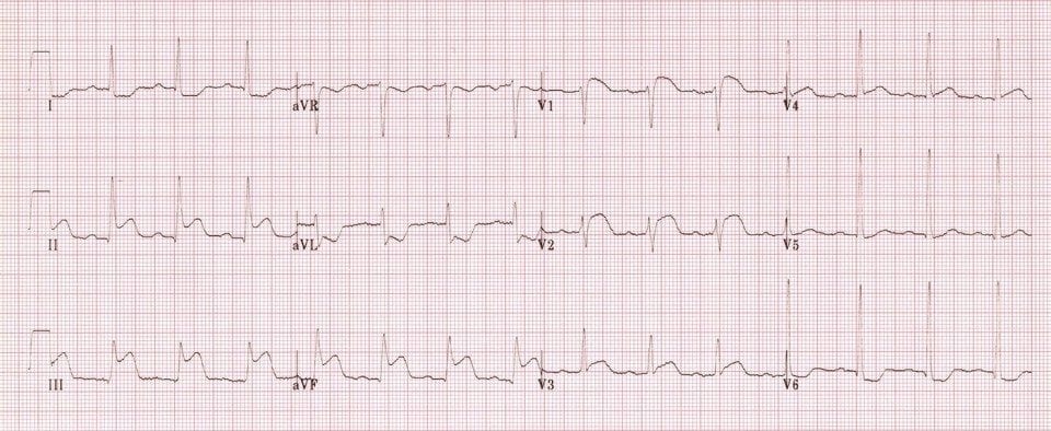 TOP 100 ECQ QUIZ LITFL 001