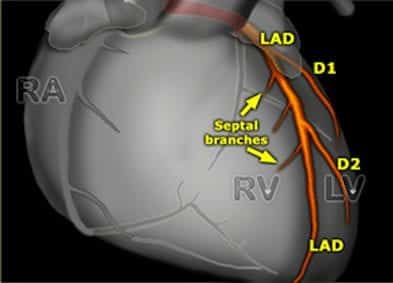 coronary-anatomy2