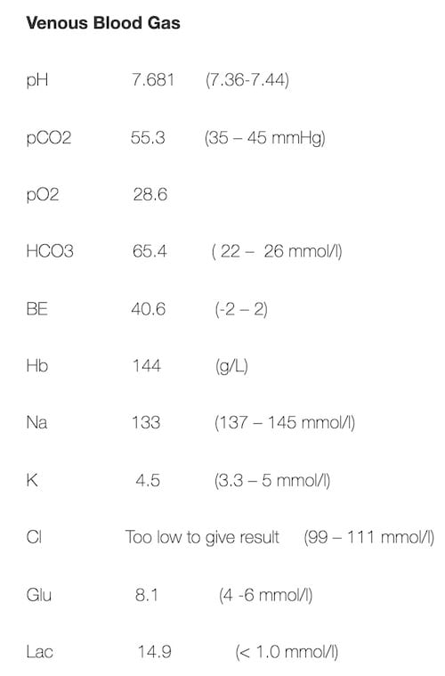 ECG Case 096 VBG result