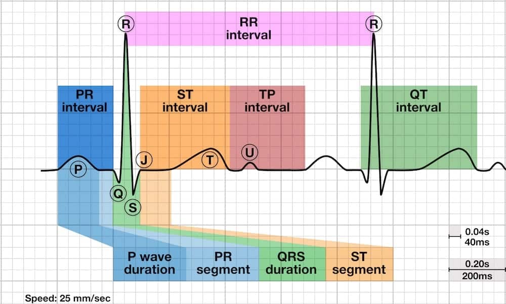 ECG basics: waves, segments and intervals LITFL ECG library