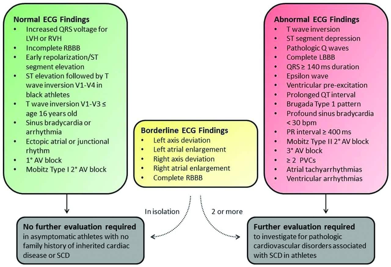 International criteria for electrocardiographic interpretation in athletes: