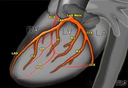 Coronary Anatomy LAD