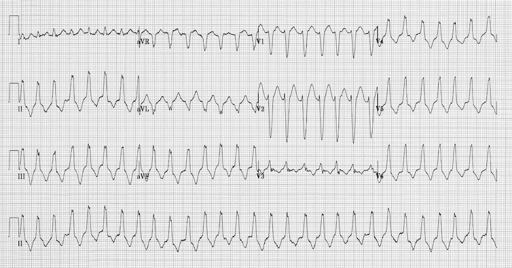 ECG-exigency 008_1 2