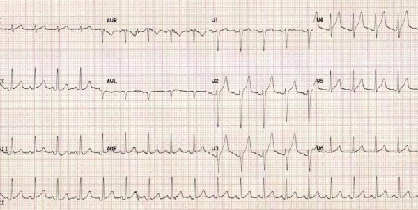 ECG 012 Metabolic Mayhem 003