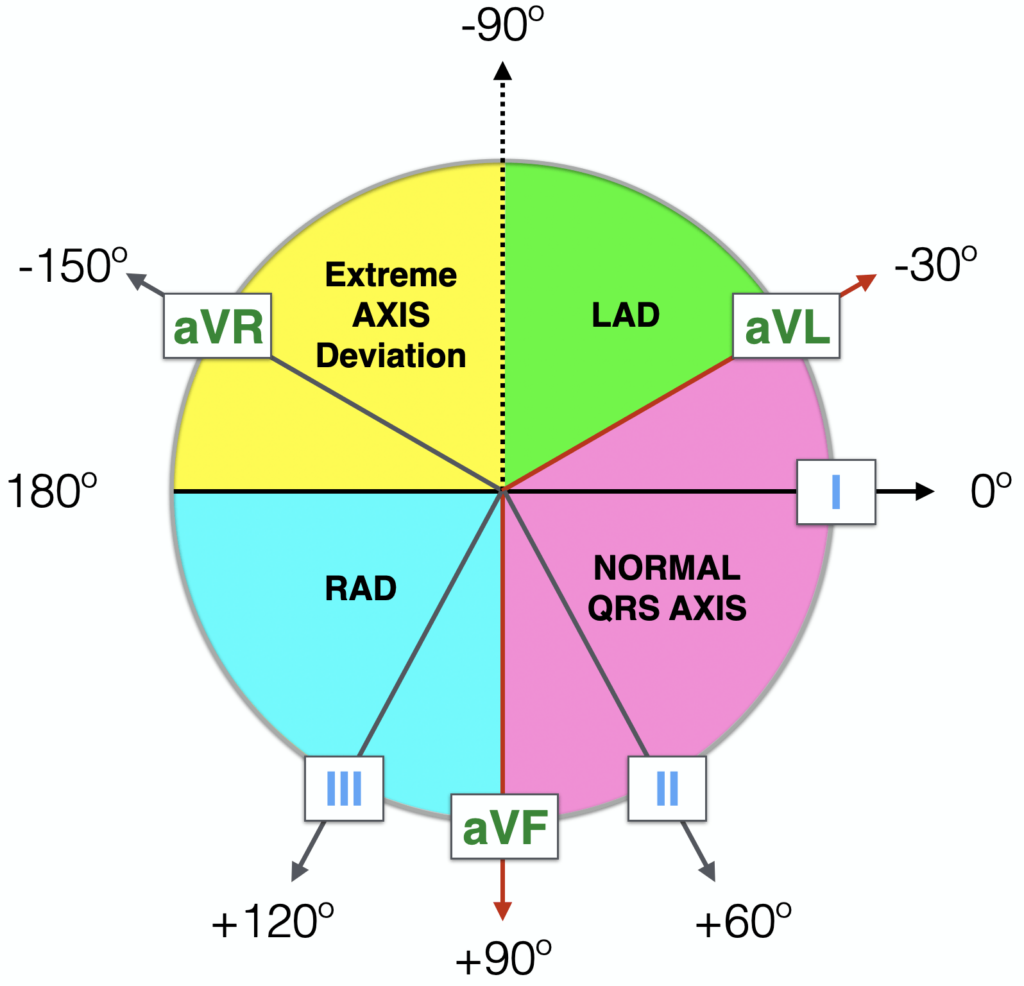 Haxaxial ECG AXIS Reference 2021