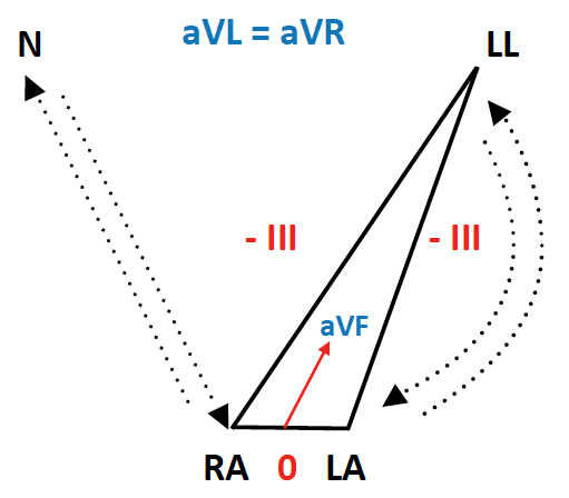 ECG Lead reversal bilateral arm leg reversal diagram