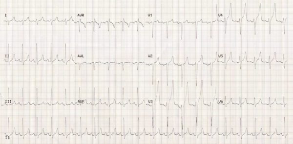 ECG 012 Metabolic Mayhem 002