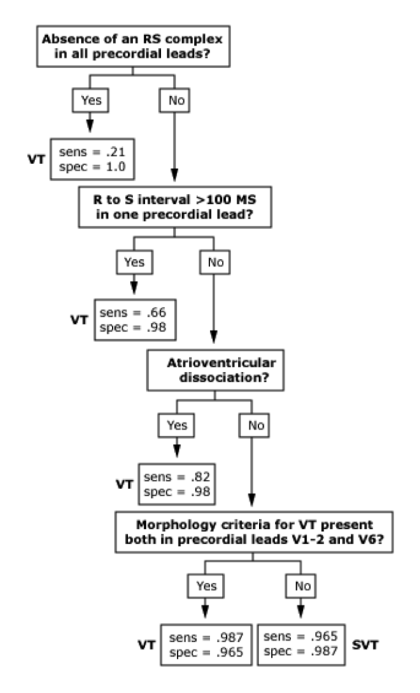 Brugada criteria VT diagnosis