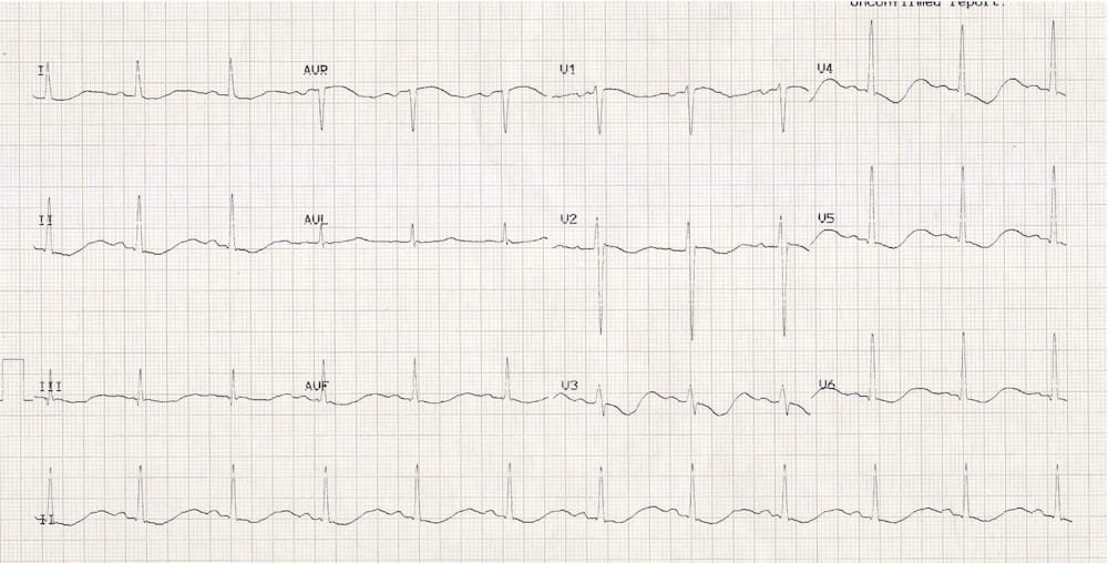 ECG 012 Metabolic Mayhem 001