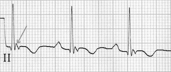 epsilon-wave-IIb-590x250 2