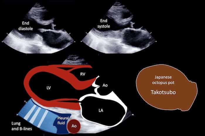 Ultrasound Top 100 091 07 Key to image 1