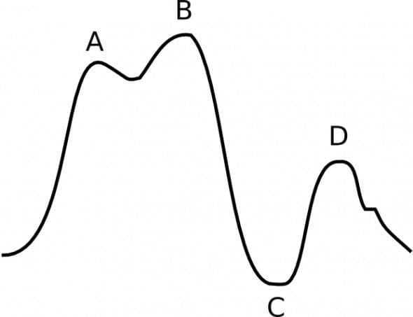 IABP Waveform