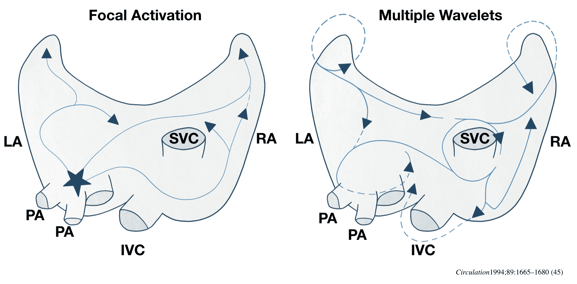 AF Circuits Focal activation Multiple wavelets 2